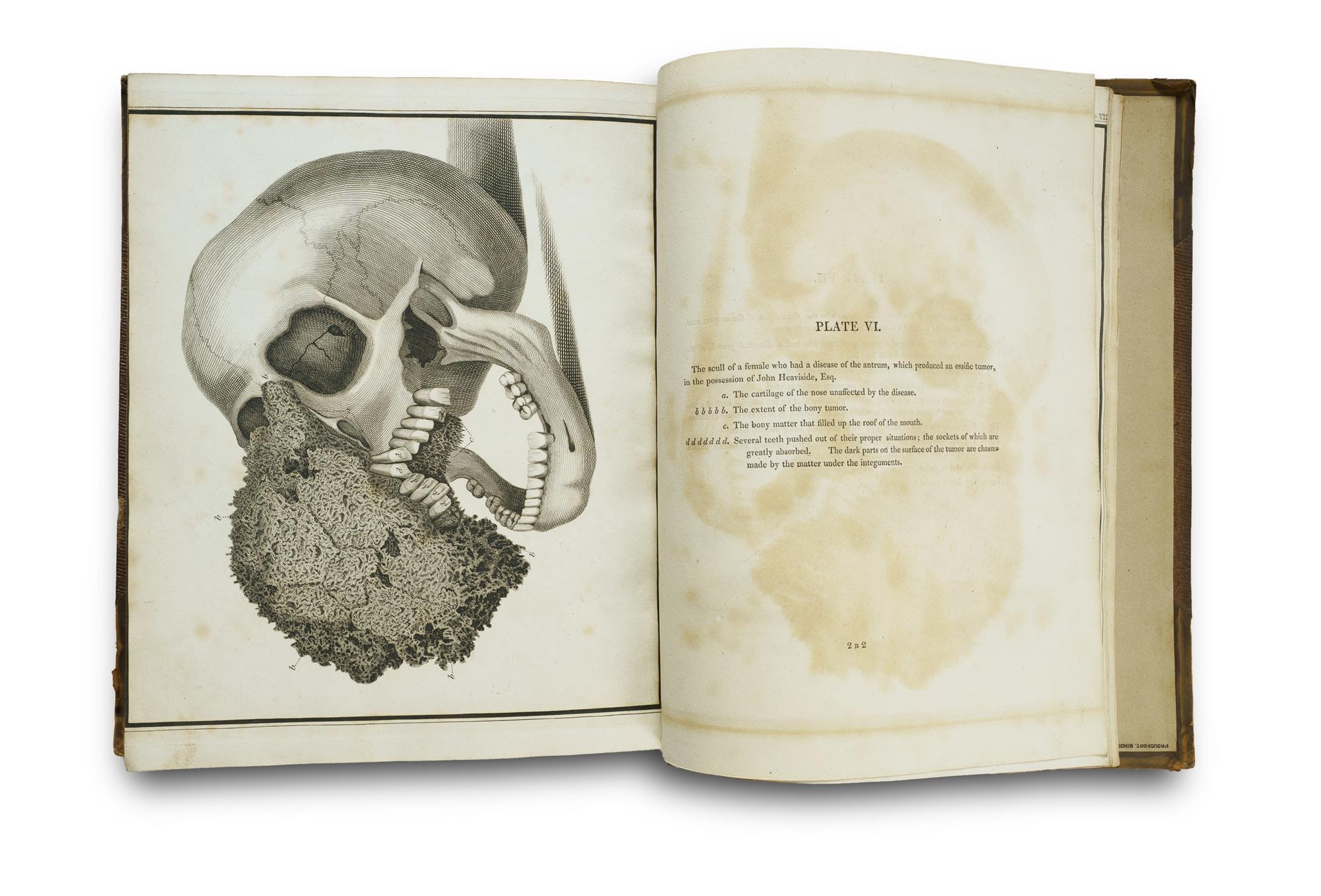 Three Volumes on the History of Teeth: Charles Allen (1687 Reprint) and Jos